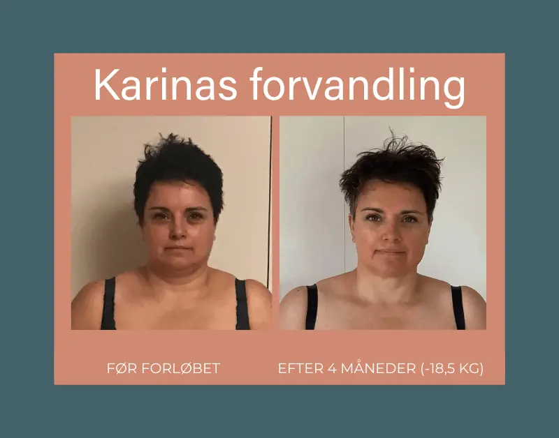 Karina Tinggaards forvandling